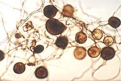 Endomykorrhizasporen